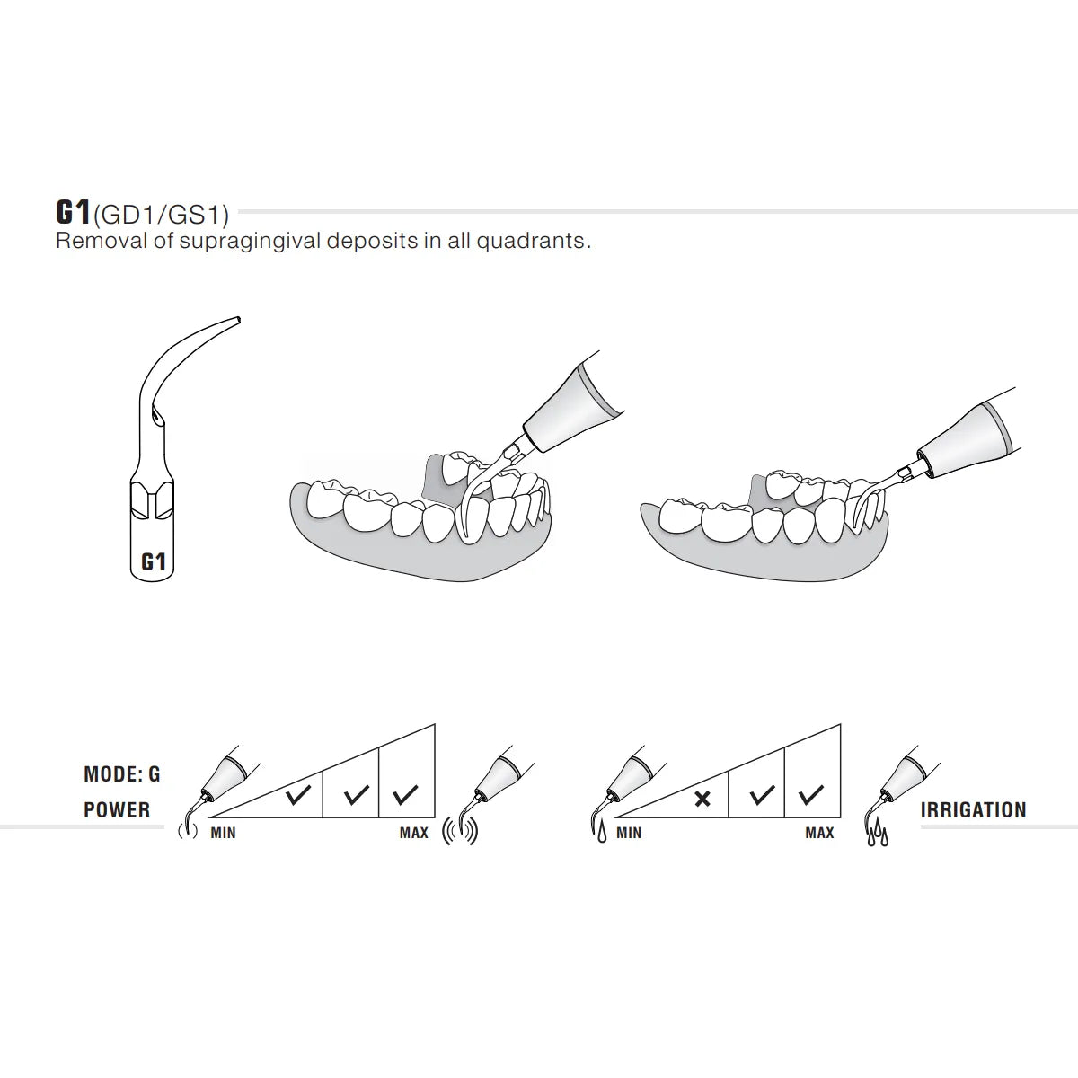 Woodpecker Scaler Tip G1 for UDS & EMS Scalers