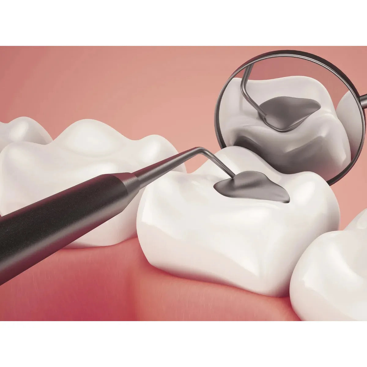 Api Plastic Filling Instrument - 1 (Pfi3)