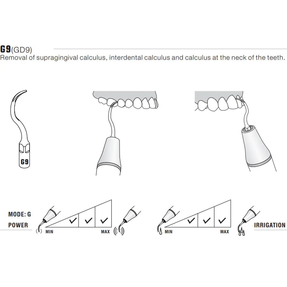 Woodpecker Scaler Tip G9 for UDS & EMS Scalers