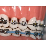 OrthoMetric Flexy NiTi Orthodontic Springs