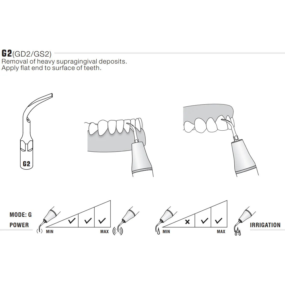 Woodpecker Scaler Tip G2 for UDS & EMS Scalers