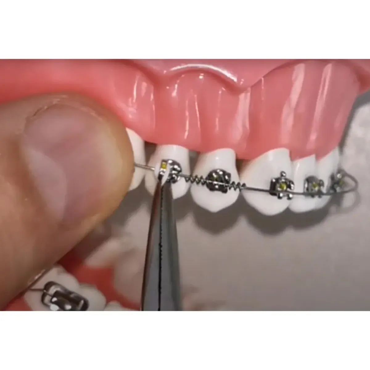 OrthoMetric Flexy NiTi Orthodontic Spring Open (Ø0.75mm X 178mm) - 35.20.0010