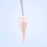 Woodpecker Scaler Tip ED3 for DTE & Satelec Scalers