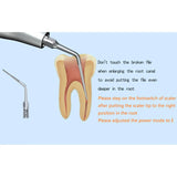 Woodpecker Scaler Tip E3D for UDS & EMS Scalers