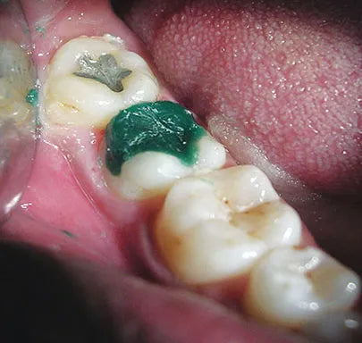 Maarc Pattern Wax