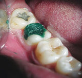 Maarc Pattern Wax