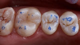 Maarc Dental Articulating Paper - 40µ Microns & 100µ Microns