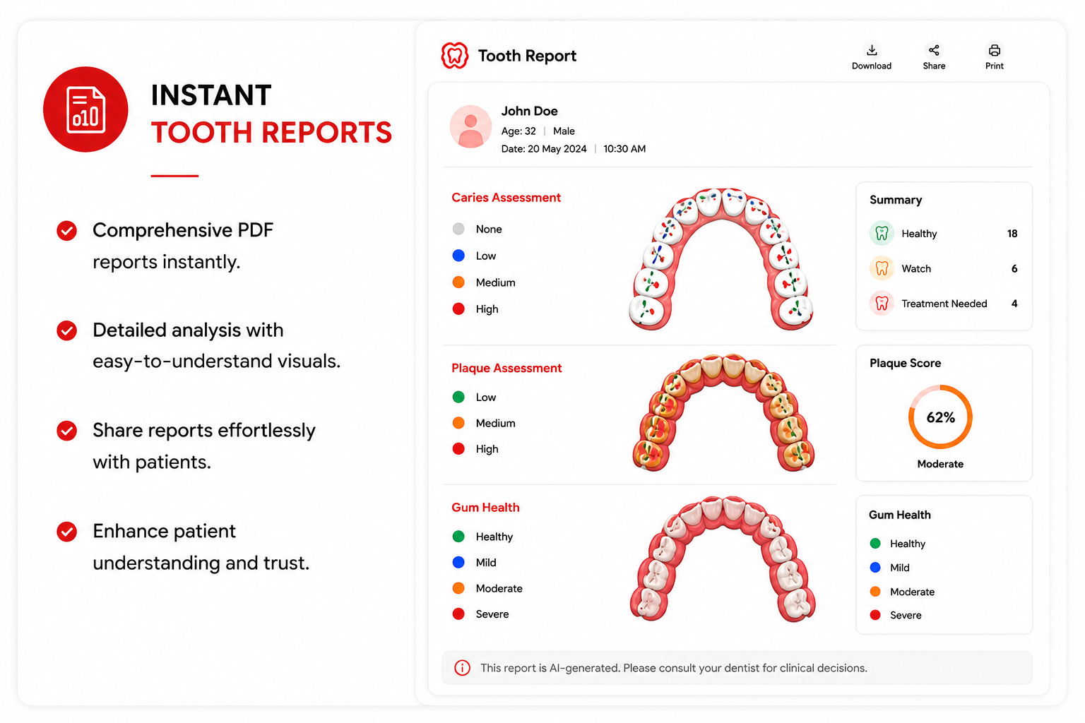 WoodPecker Smile 2 Intraoral Scanner