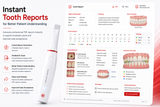 WoodPecker Smile 2 Intraoral Scanner