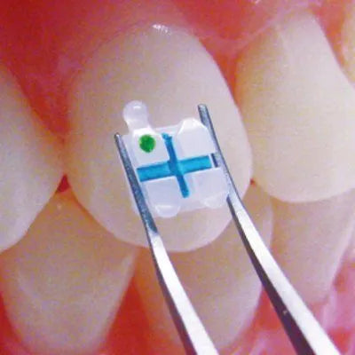 3m Unitek Clarity Advanced Ceramic Brackets