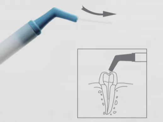 Refer & Earn Cotisen Endodontic Aspirator Tip ( Pack of 1 )