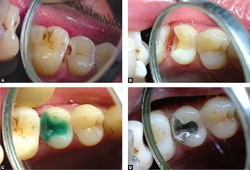 Maarc Pattern Wax