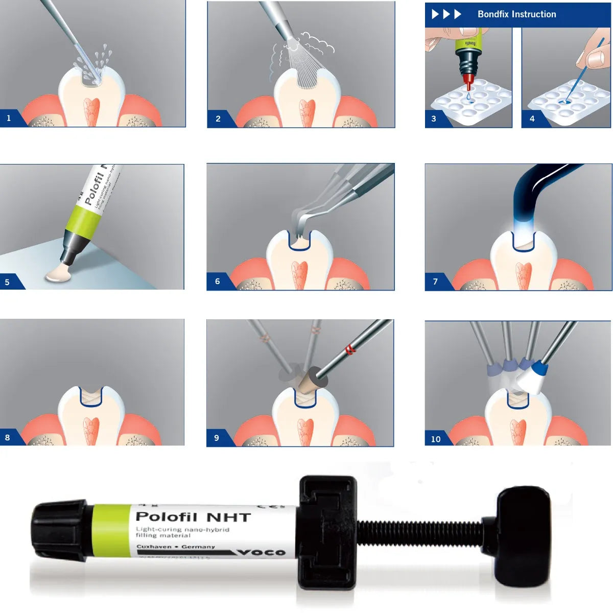 Voco Polofil Nht Syringe Refills 4g