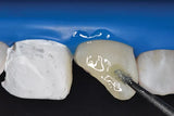 Cotisen Dental Micro Applicators Tips