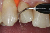 SafeEndo ReCreate LC Flow