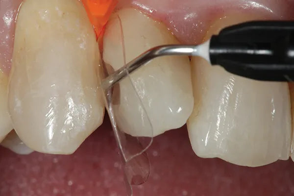 SafeEndo ReCreate LC Flow