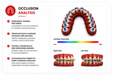 WoodPecker Smile 2 Intraoral Scanner