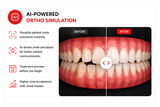 WoodPecker Smile 2 Intraoral Scanner