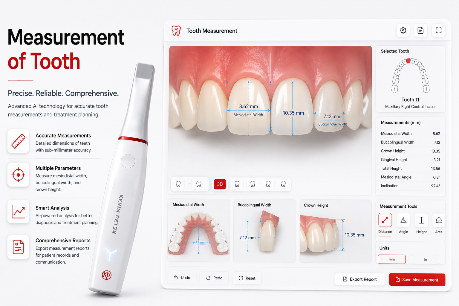 WoodPecker Smile 2 Intraoral Scanner
