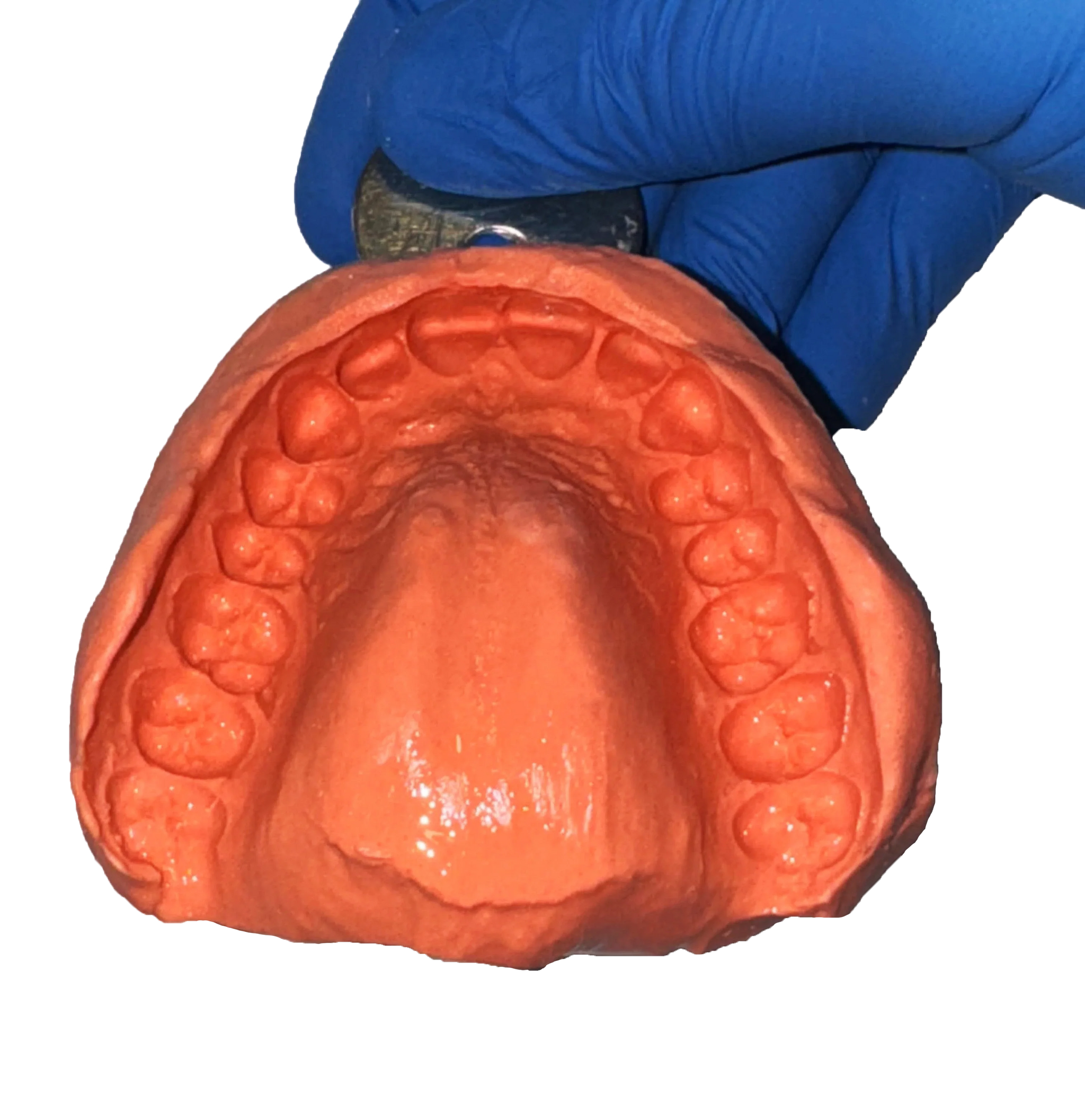 Avue Hydrosol - Regular Setting, Non chromatic, Dust free Alginate Impression Material