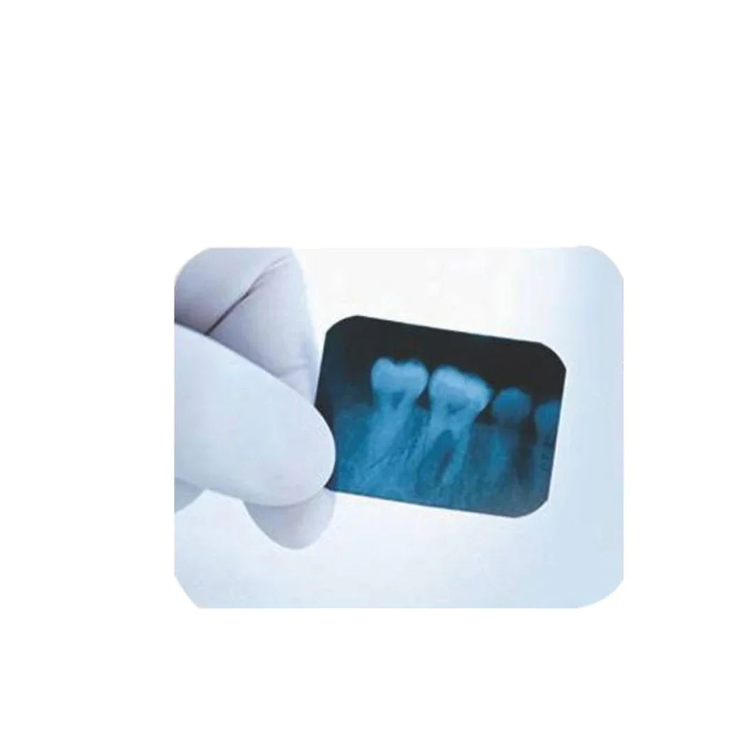 AVUE Xpress SD - Self Developing X-Ray Films