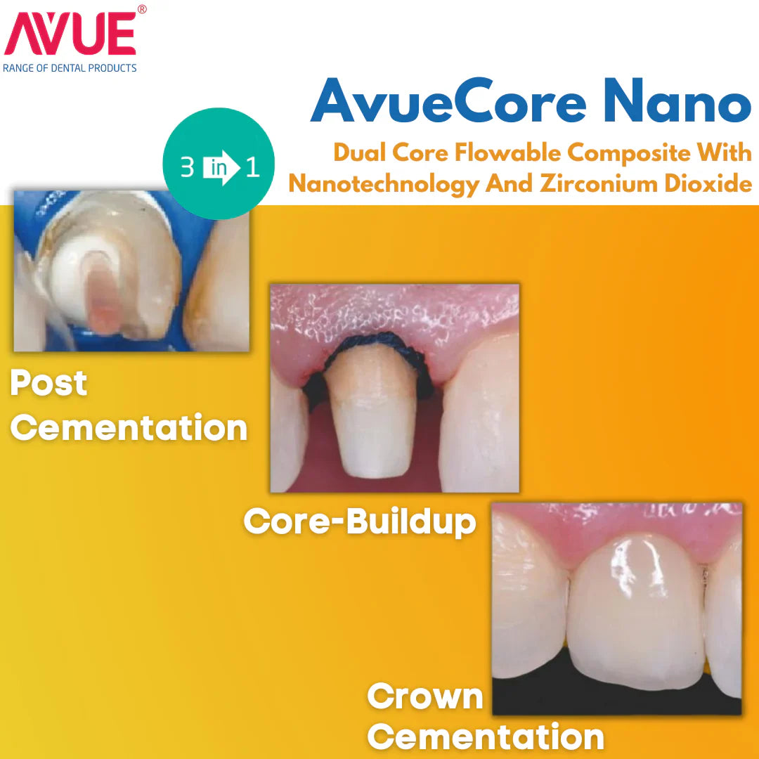 AVUE AvueCore Nano - Dual Cure Flowable Core Buildup composite with Nano Zirconium Dioxide