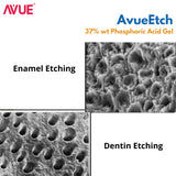 AVUE AvueEtch- 37% wt Phosphoric Acid Gel