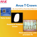 AVUE AvueT Crown - Flurorescent Temporary Crown & Bridge Material