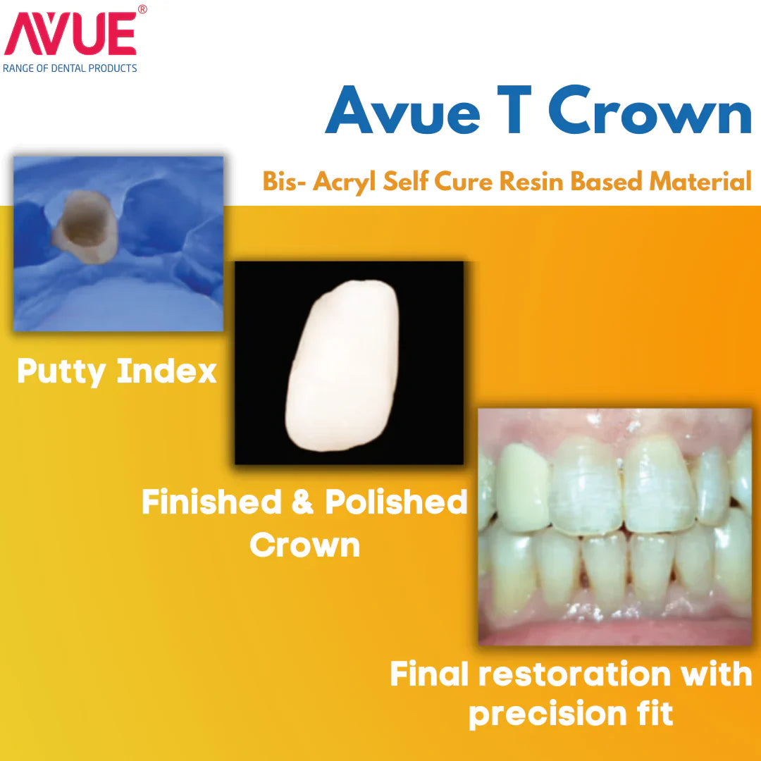 AVUE AvueT Crown - Flurorescent Temporary Crown & Bridge Material