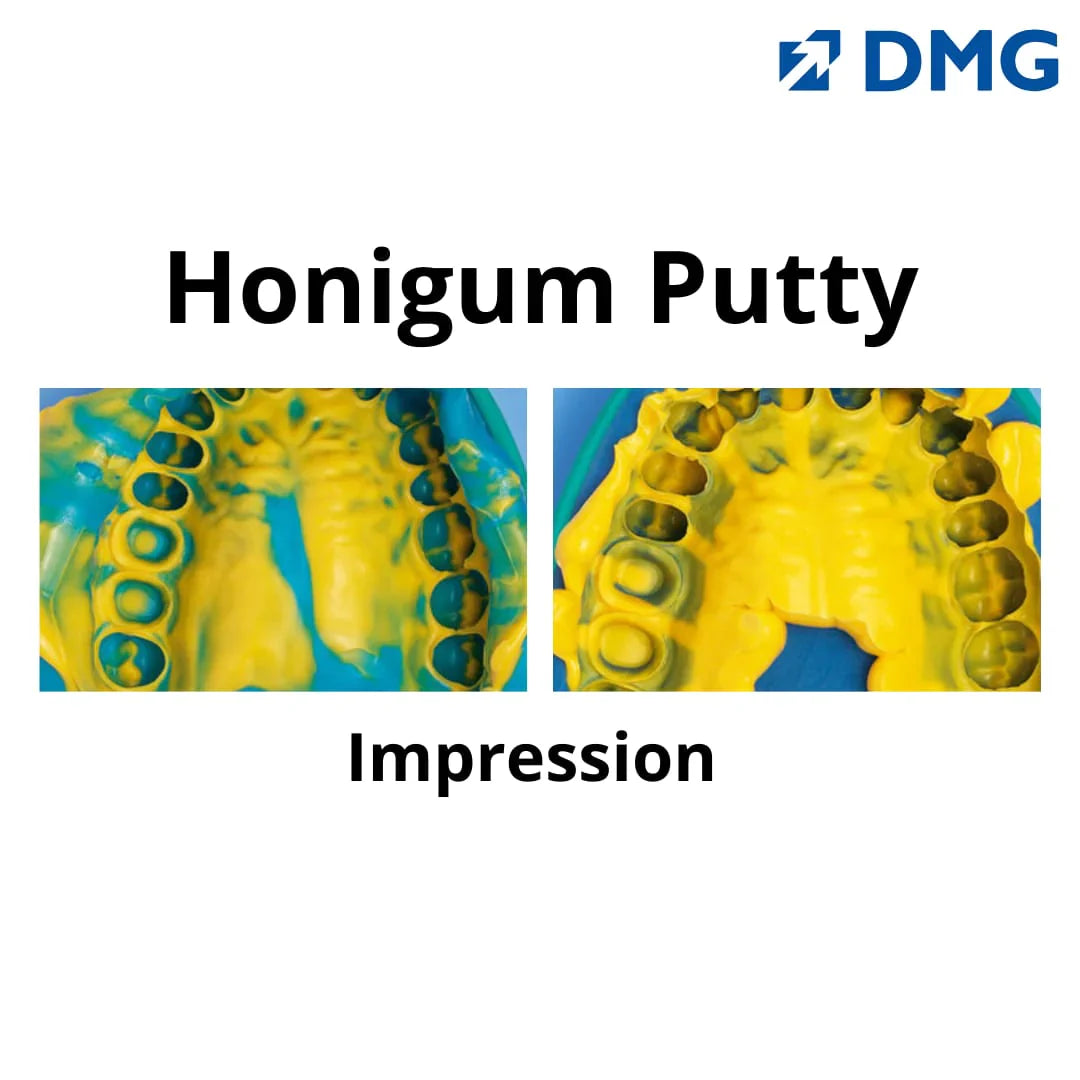DMG Honigum - A-Silicone Impression Material