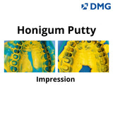DMG Honigum - A-Silicone Impression Material