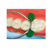 TDV Elastic Wedges - (Pack of 75) Dental Restorative Assorted Wedges