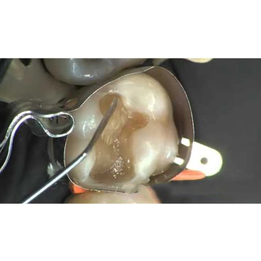 Gdc Device GDC Restore Instrument - Applica – Dentaid Devices