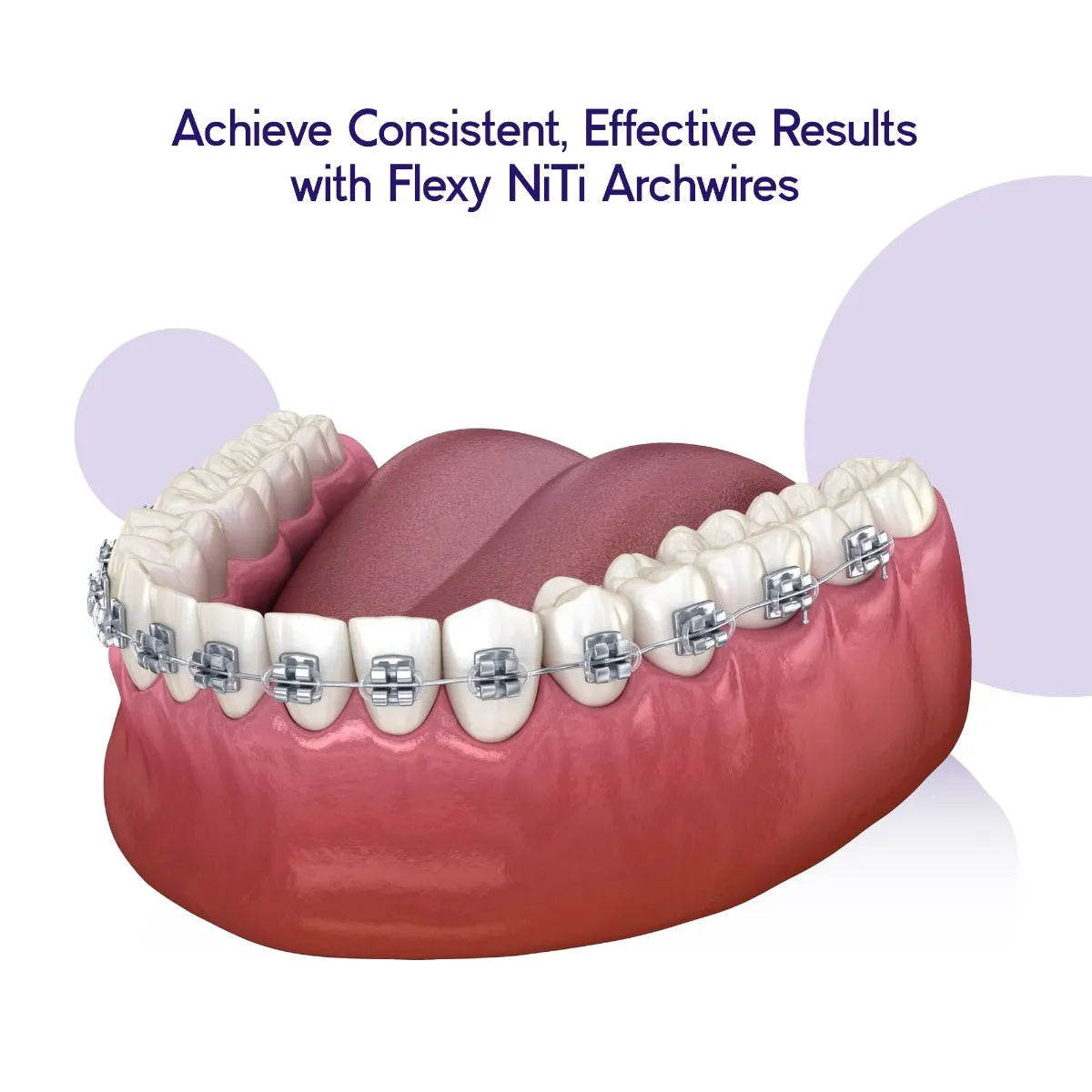 OrthoMetric Flexy NiTi Reverse Curve Intraoral Archwires - Round (10/Pk)