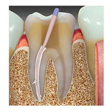 Prevest Denpro CalAPex Root Canal Sealer Manual Mix (40041-2)