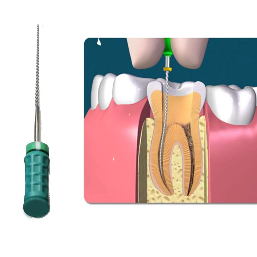 Dentsply M-Access K-Files 31mm