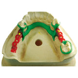 Maarc Clasp Profile Waxes