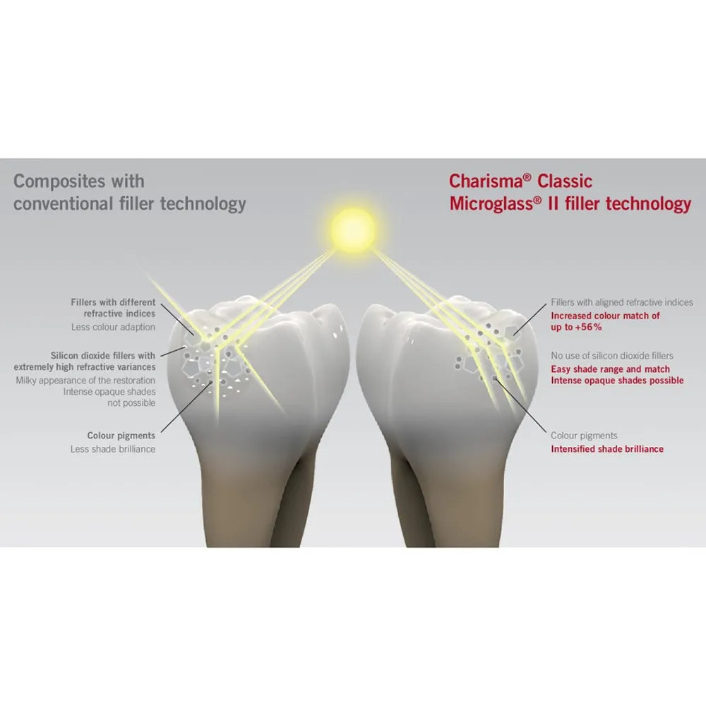 Kulzer Charisma Classic Composite Restorative Kit- With Gluma Bond Universal