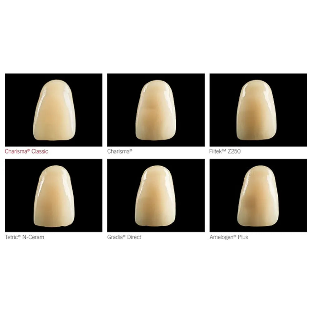 Kulzer Charisma Classic Composite Restorative Kit- With Gluma Bond Universal