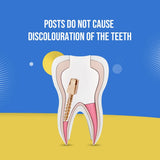EndoKing Dental Conical Screw Posts