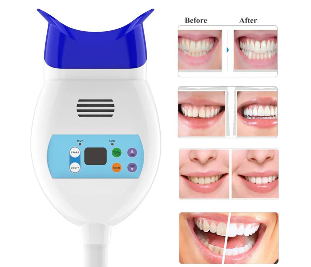 Endoking Bright Bleaching Unit
