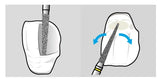 Shofu Direct Cosmetic Restoration Kit