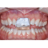 Maarc Eazy Tray 100gm