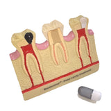 Septodont Biodentine (Single Pouch)