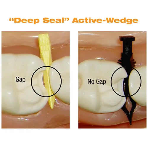 DualForce™ Active-Wedges (pack of 25)