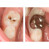 3m Espe Ss Crown Primary Molar - Intro Kit Nd96