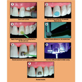 Prevest Denpro Fusion Crysta Orthodontic Adhesive Kit (10024)