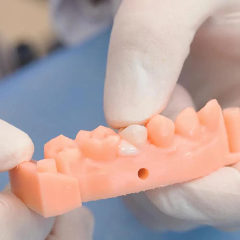 Vincismile TopCEM Dual Cure Resin Cement