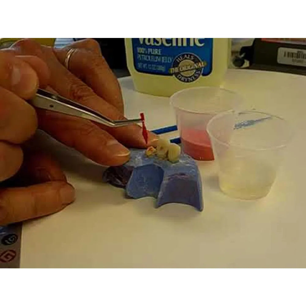 GC Pattern Resin 1-1 Package