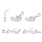Woodpecker Scaler Tip for UDS & EMS Scalers